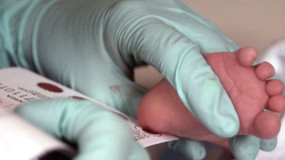 غربالگری نوزادان؛ ضرورت در روزهای آغازین زندگی